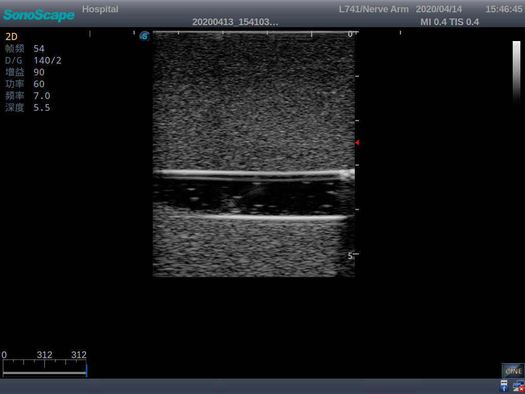 PICC Ultrasound Training Model 