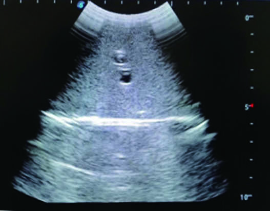 Femoral Arteriovenous Puncture & Abdominocentesis Ultrasound Training Model 
